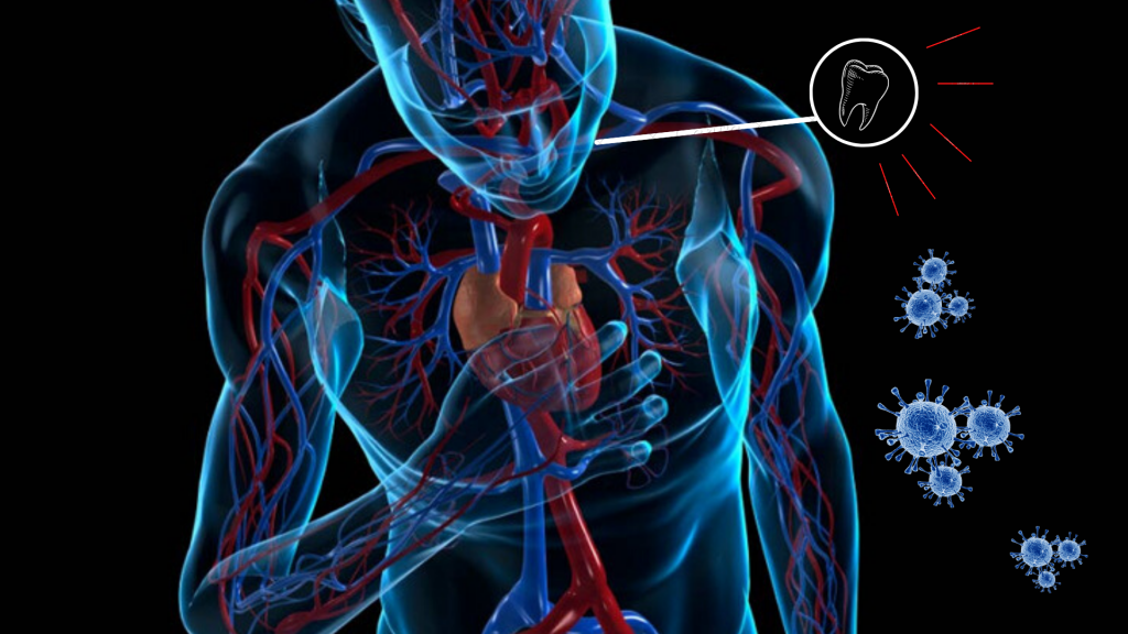 ALIANZA PELIGROSA: PERIODONTITIS + ENFERMEDADES CARDIOVASCULARES + COVID 19  – Clínica Maza